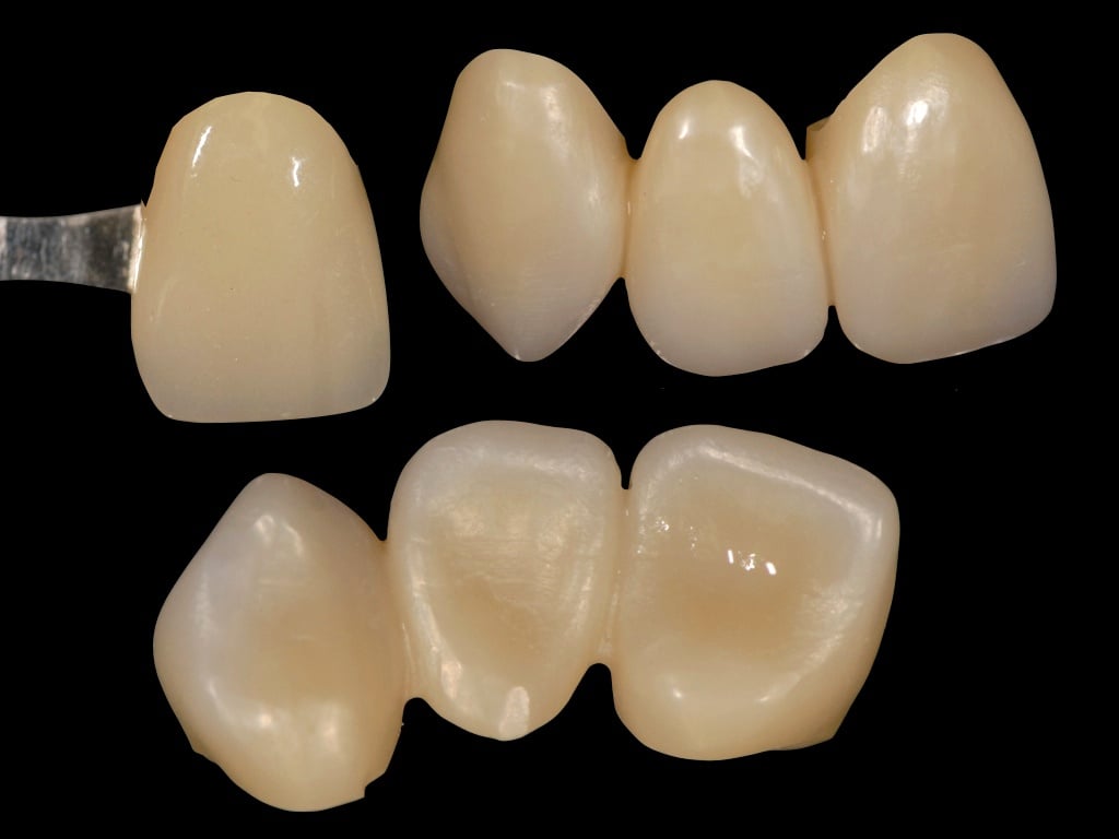 A Look at Zirconia in the Dental Lab [Infographic]